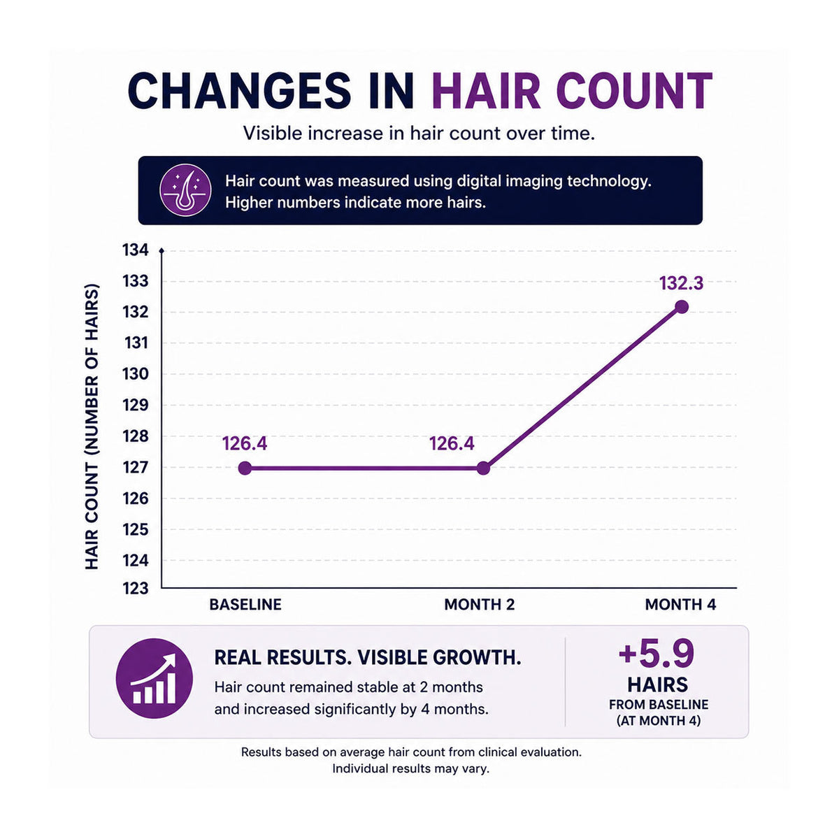 FOLIGAIN® Triple Action Shampoo For Thinning Hair For Women with 2% TRIOXIDIL®